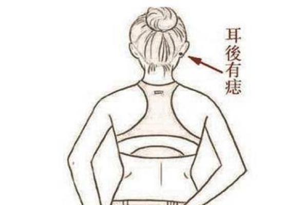 耳朵上的胎记算命分析