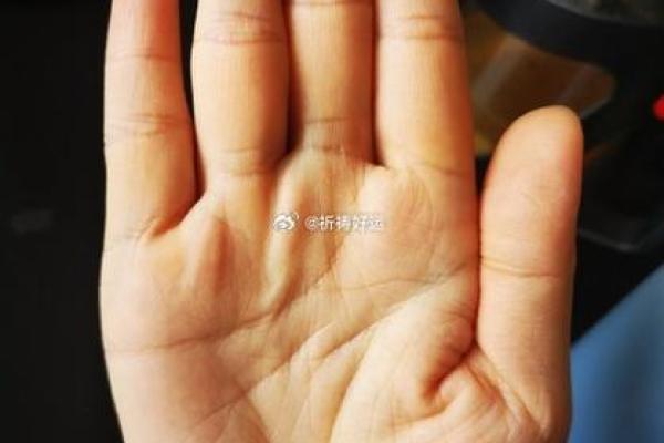 算命的说，手腕上有这样的纹路，一定会破财！