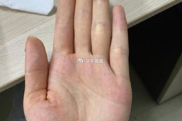 手相风水：命运线中间断开象征什么意义