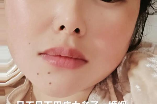 女人有黑观音痣 下巴的痣房屋多