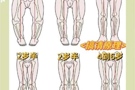 小孩走路内八字