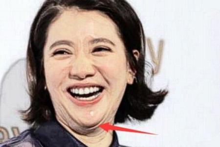 牙齿算命 有鬼牙不吉利吗
