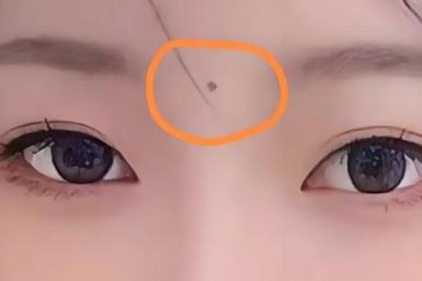 印堂痣和观音痣的区别,观音痣是大富大贵的代表