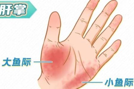 朱砂掌算命，手掌红就是朱砂掌吗？