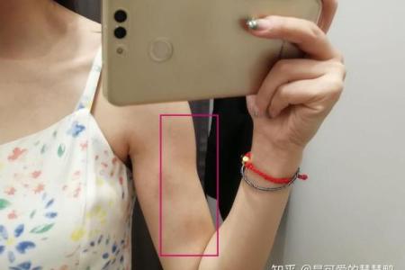 风水学上胎记中的有说明什么