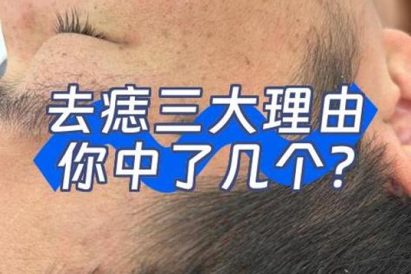祛痣要算命吗