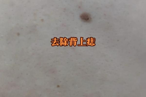 女人背部痣相图解算命