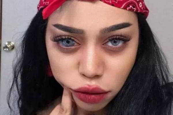 眼睛上的胎记算命分析